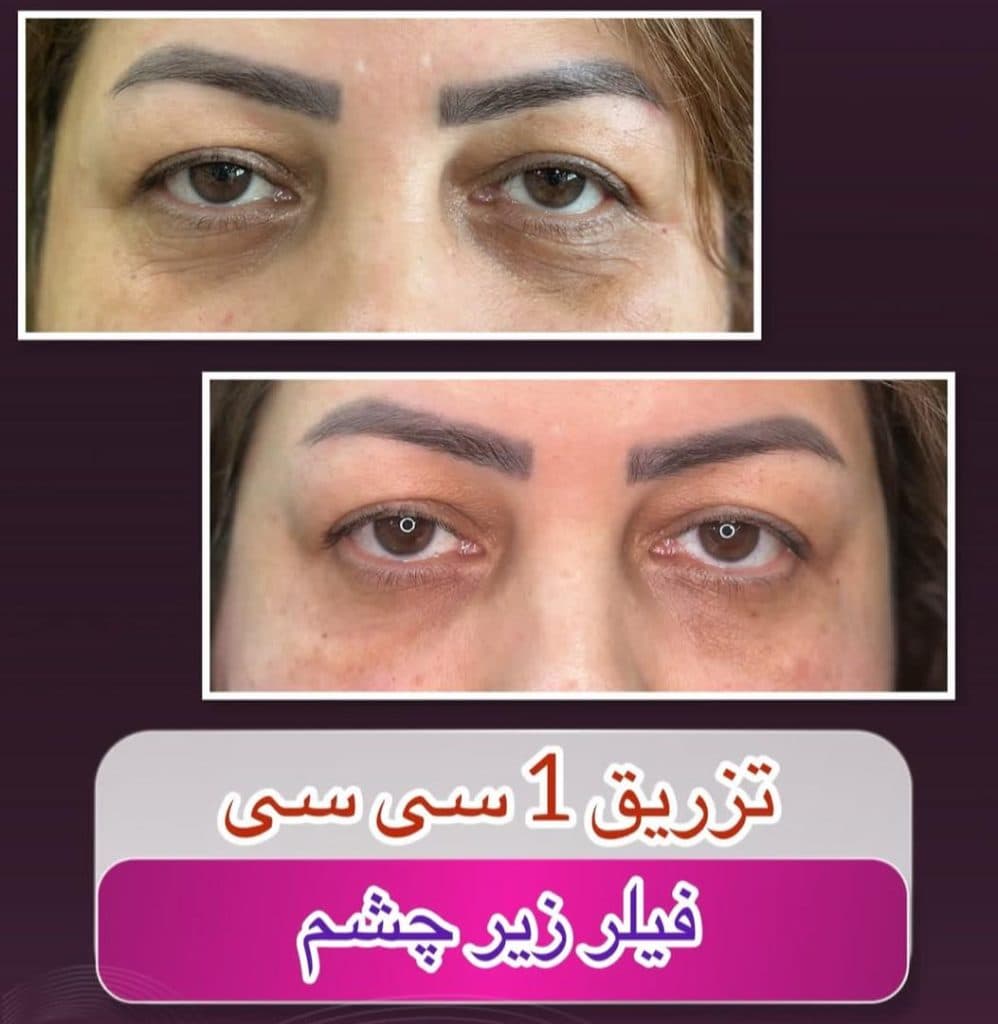 کلینیک زیبایی آوا در شهناز تبریز