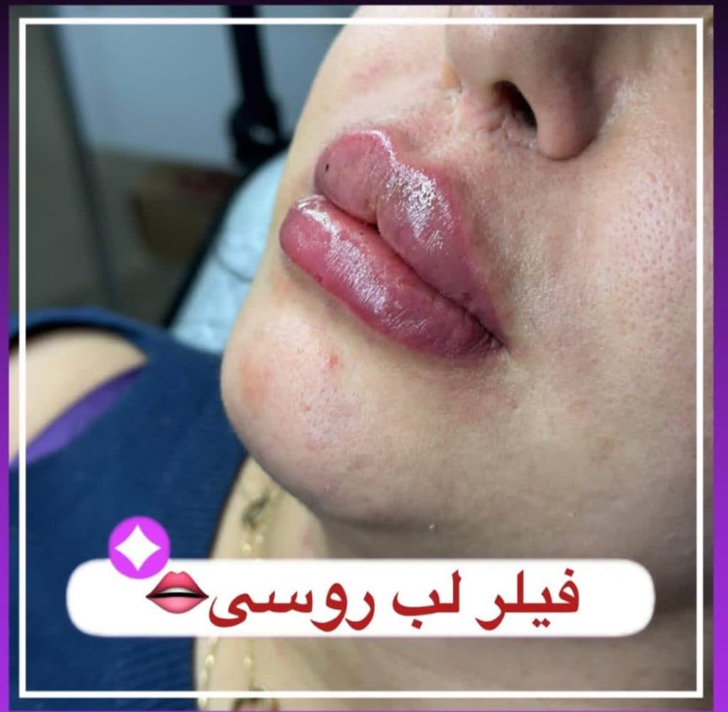 کلینیک زیبایی آوا در شهناز تبریز