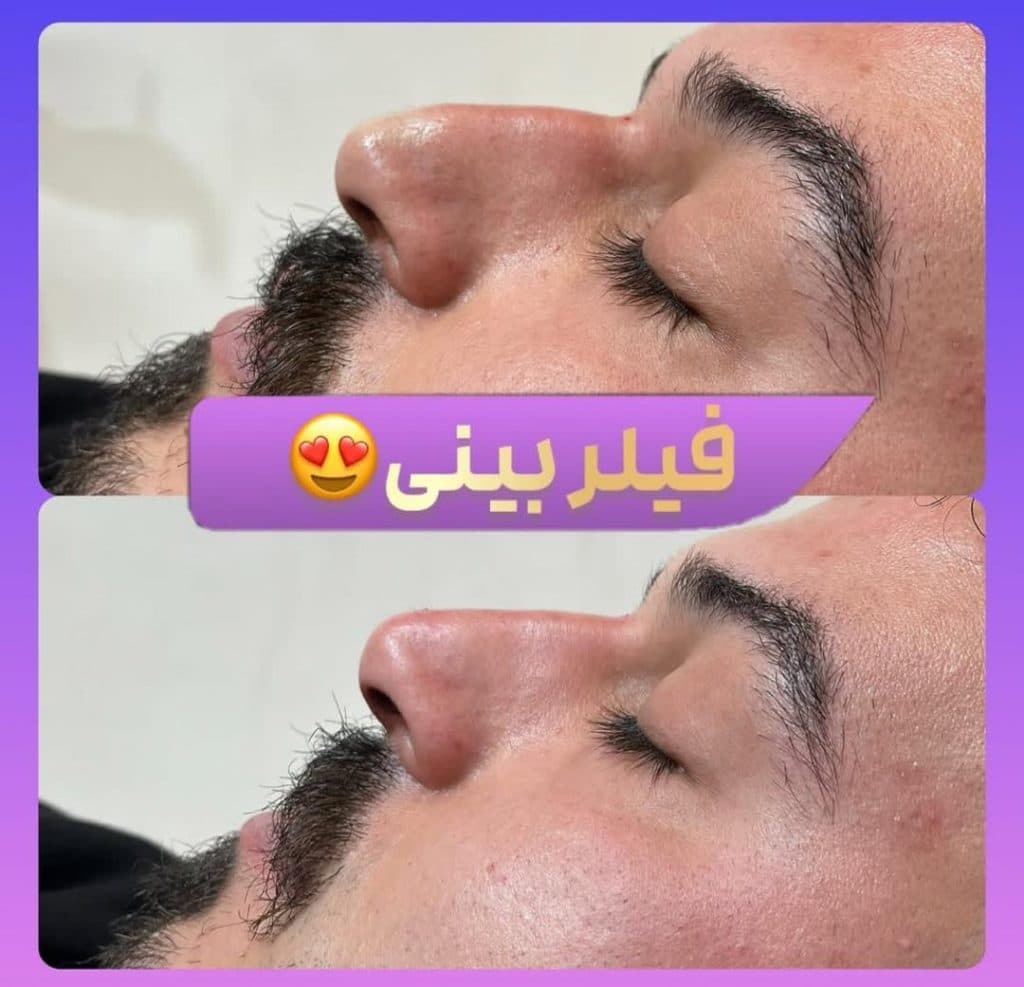 کلینیک زیبایی آوا در شهناز تبریز