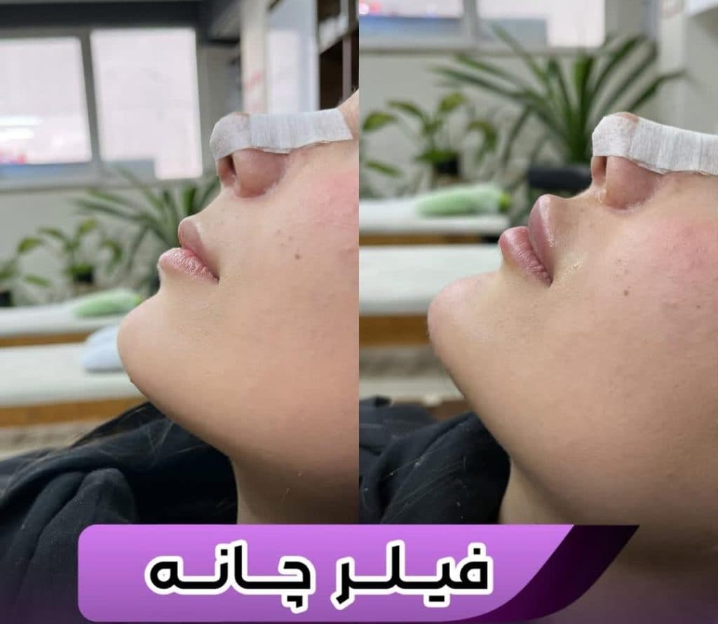 کلینیک زیبایی آوا در شهناز تبریز
