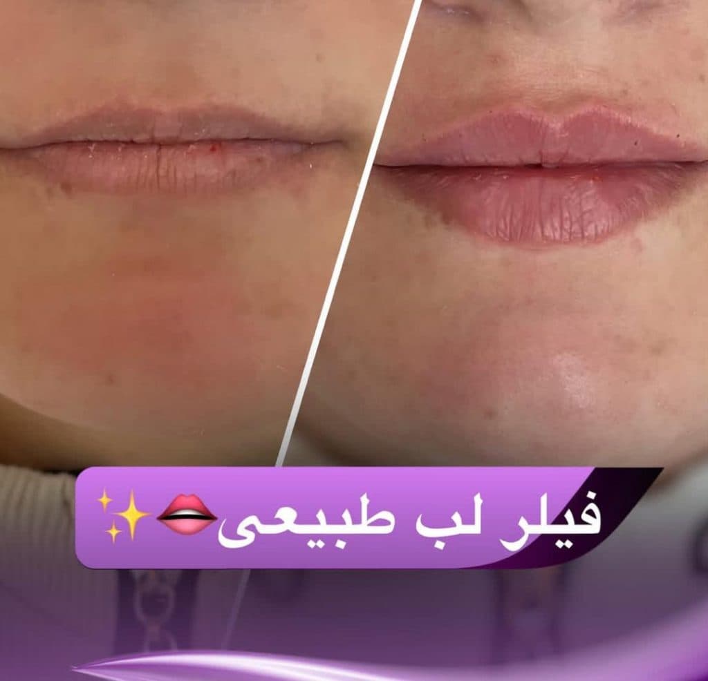 کلینیک زیبایی آوا در شهناز تبریز