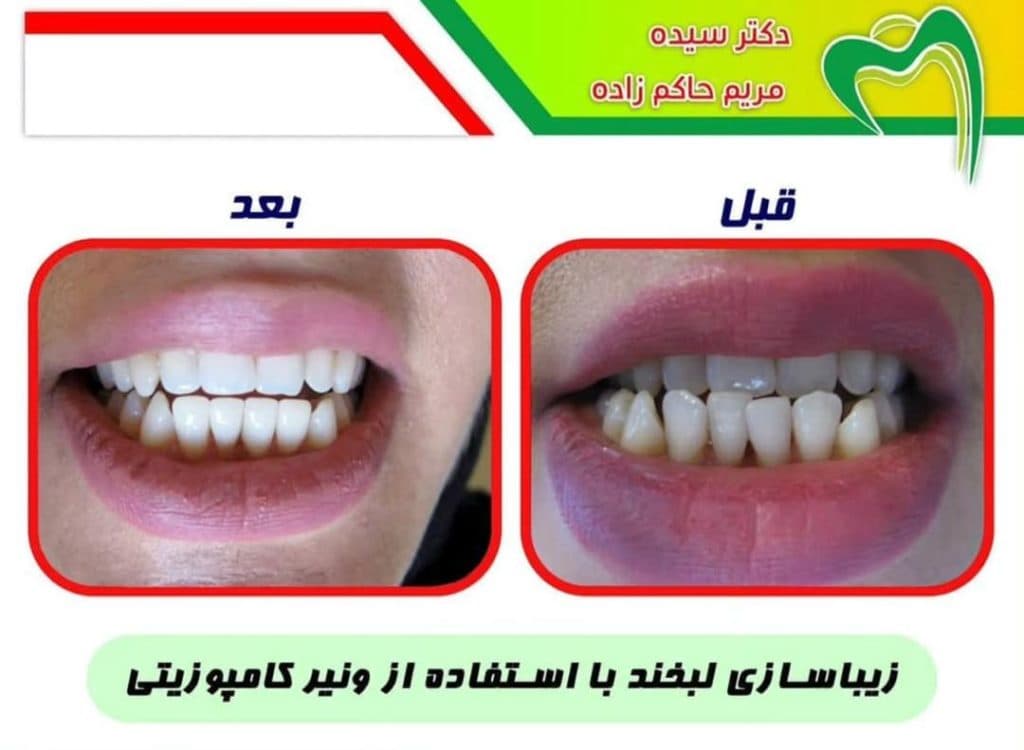 مطب دندانپزشکی دکتر حاکم زاده در سه راه اقدسیه تهران