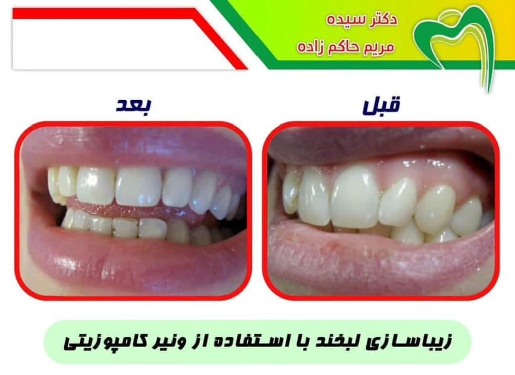 مطب دندانپزشکی دکتر حاکم زاده در سه راه اقدسیه تهران