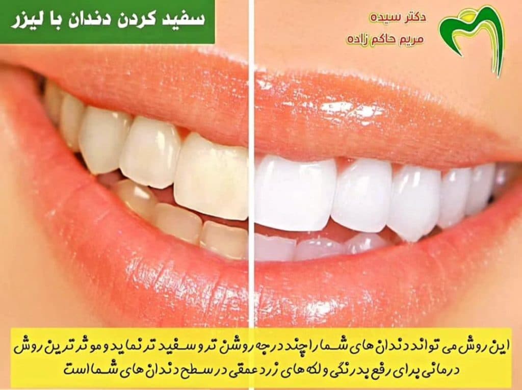 مطب دندانپزشکی دکتر حاکم زاده در سه راه اقدسیه تهران