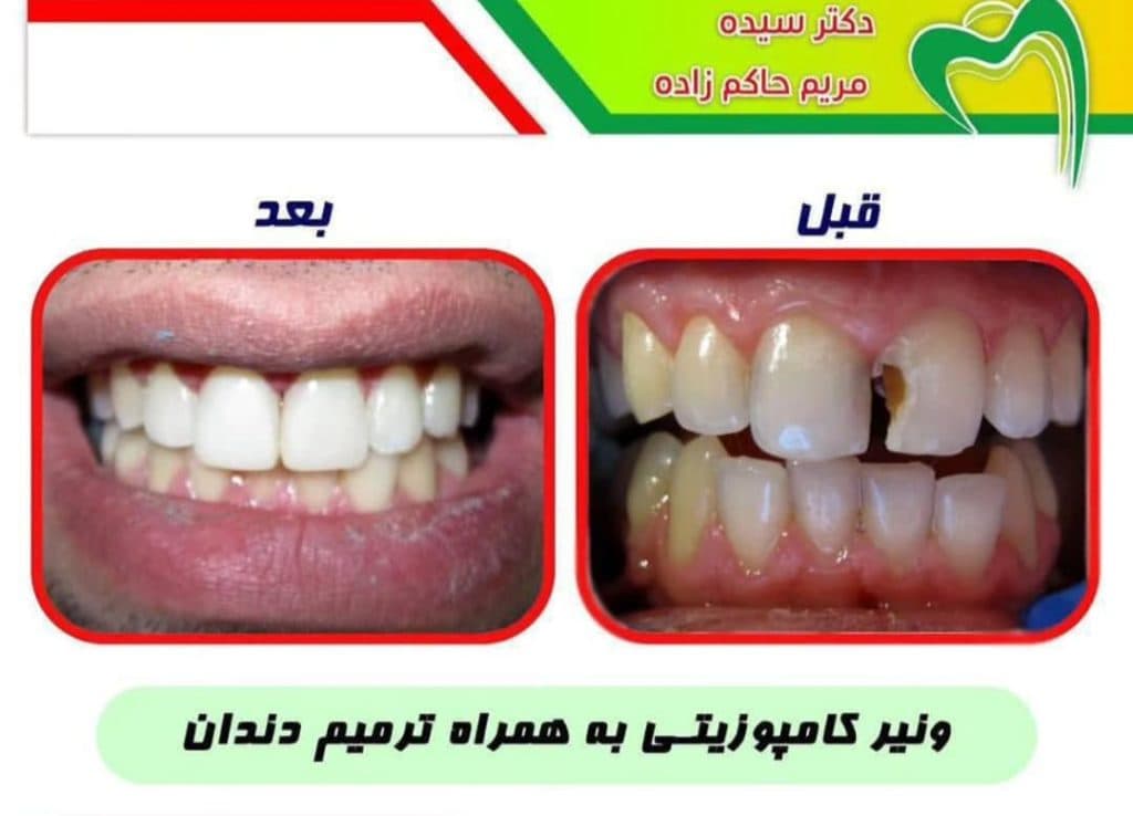 مطب دندانپزشکی دکتر حاکم زاده در سه راه اقدسیه تهران