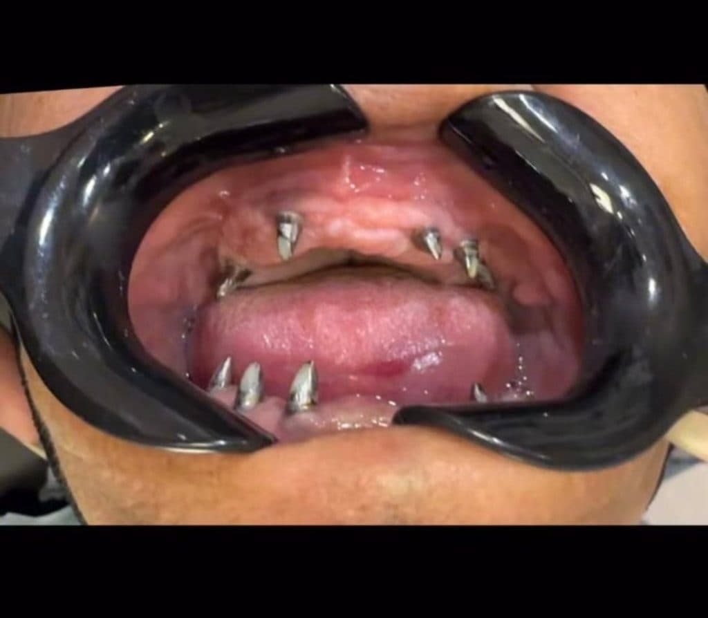 مطب دندانپزشکی دکتر کیهان احمدی در منتظری ماهشهر