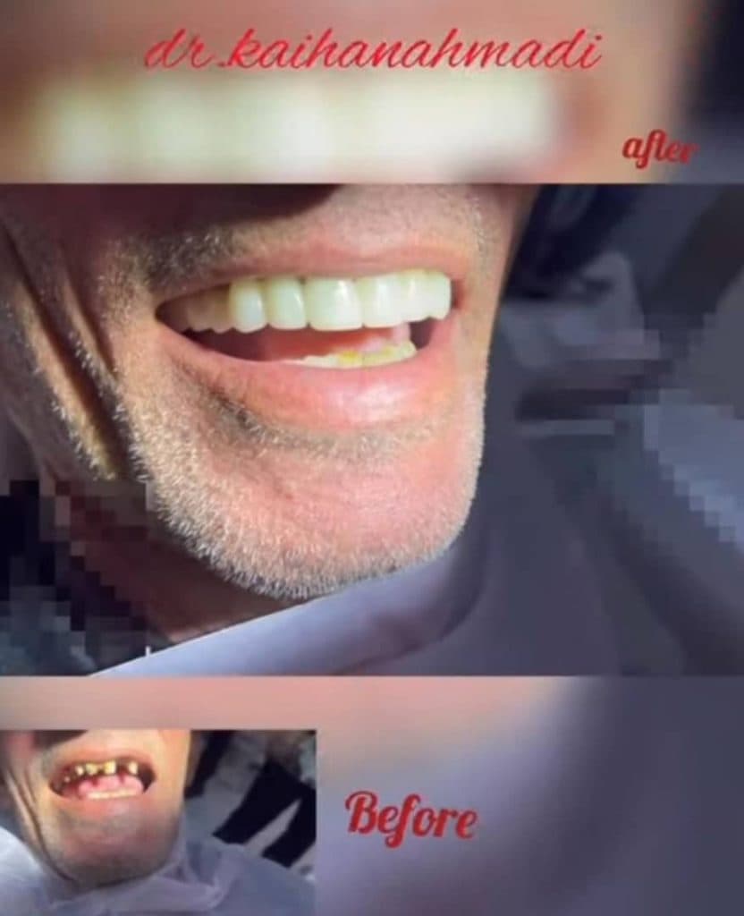 مطب دندانپزشکی دکتر کیهان احمدی در منتظری ماهشهر