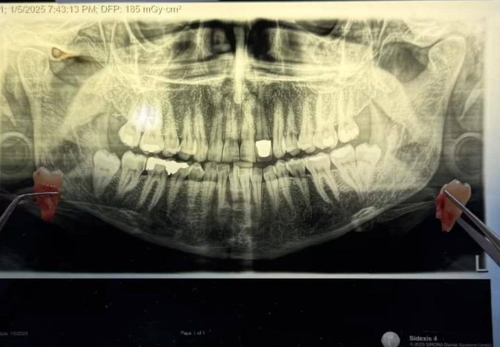 مطب دندانپزشکی دکتر کیهان احمدی در منتظری ماهشهر