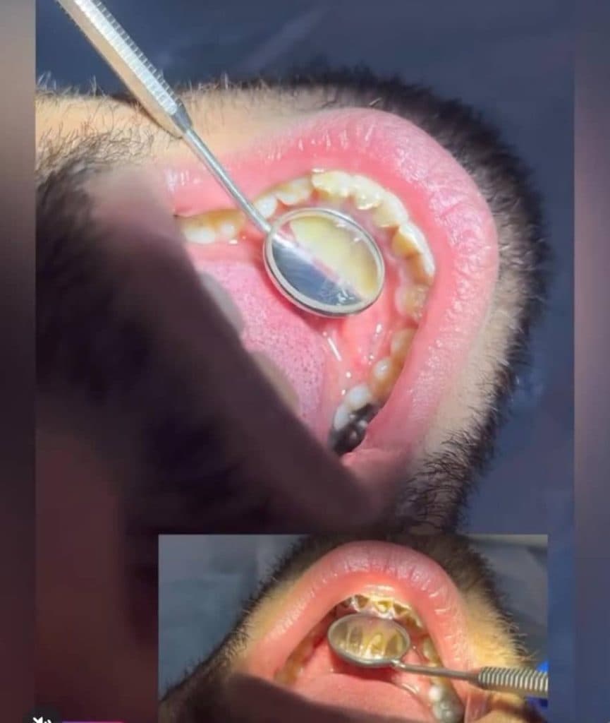 مطب دندانپزشکی دکتر کیهان احمدی در منتظری ماهشهر