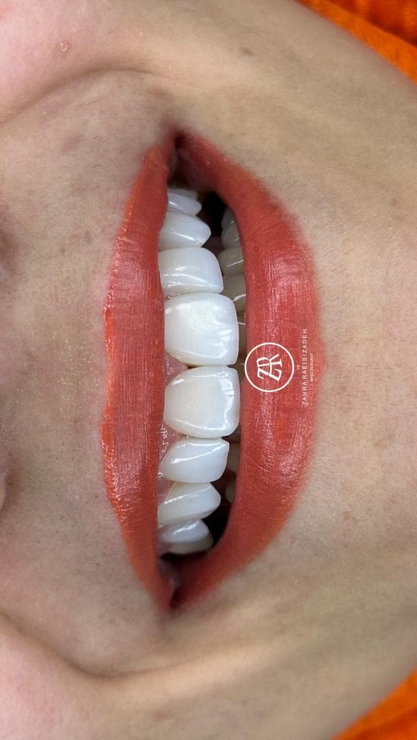 دندانپزشکی تخصصی ترمیم و زیبایی دکتر زهرا رئیسی زاده در جردن تهران