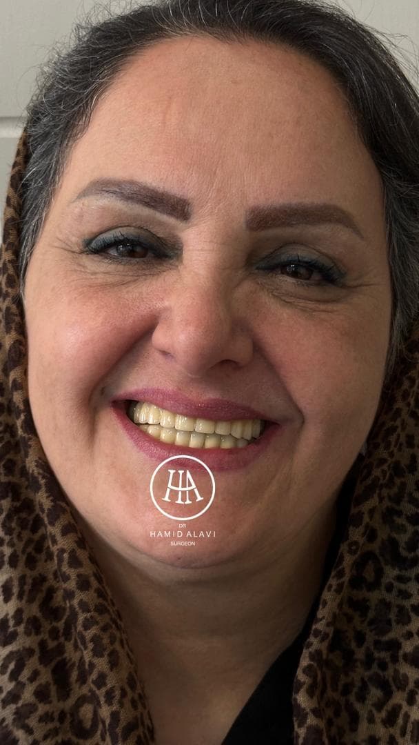 دندانپزشکی تخصصی ترمیم و زیبایی دکتر زهرا رئیسی زاده در جردن تهران