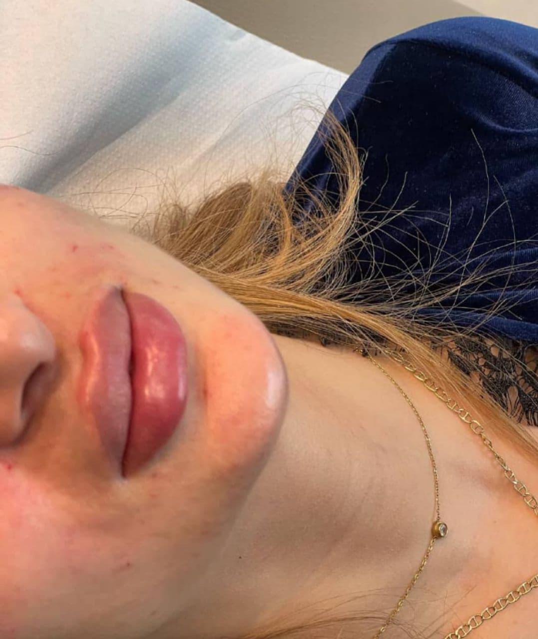 مرکز ویژه فیلر بادی آنیل در بندرعباس