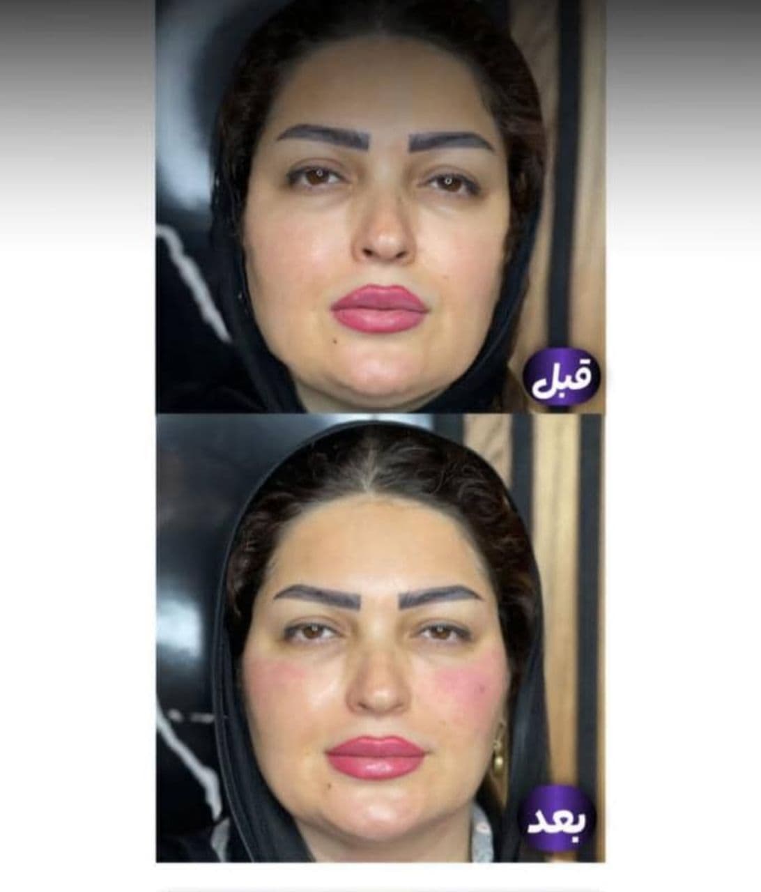 مرکز ویژه فیلر بادی آنیل در بندرعباس