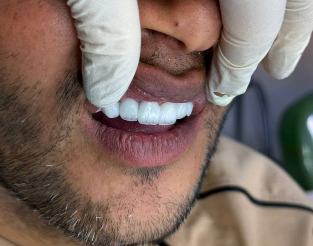 کلینیک دندانپزشکی لبخند در گوهردشت کرج