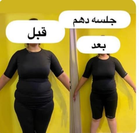 کلینیک ایکس بادی صدف در تهران