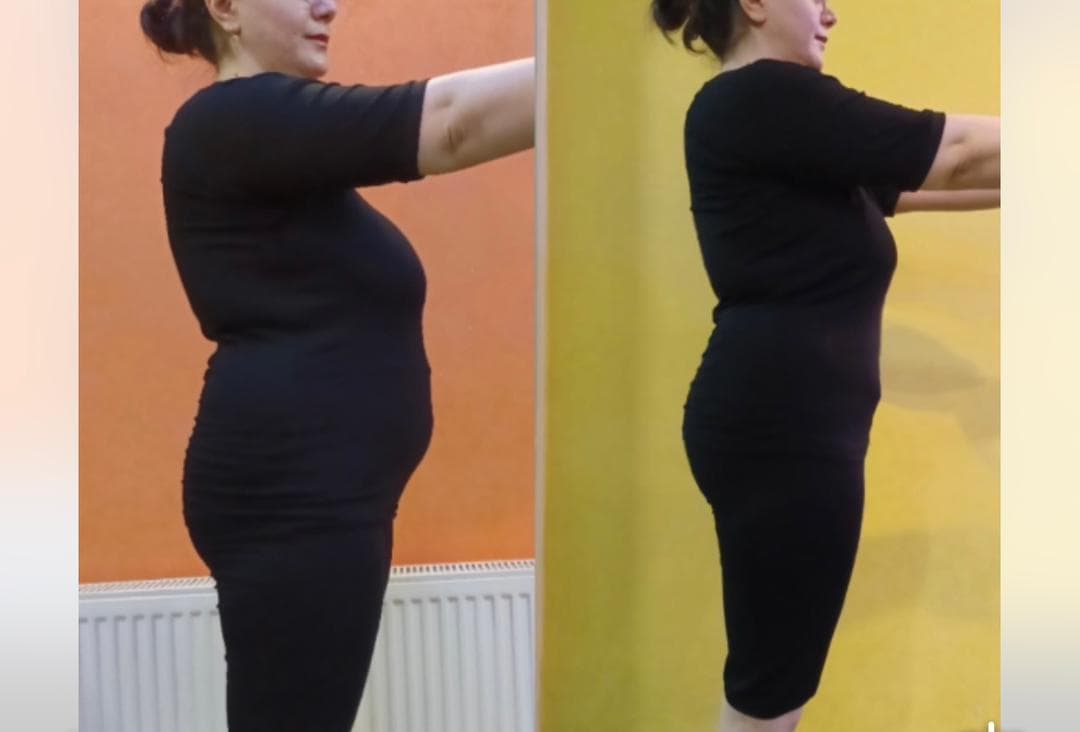 کلینیک ایکس بادی صدف در تهران