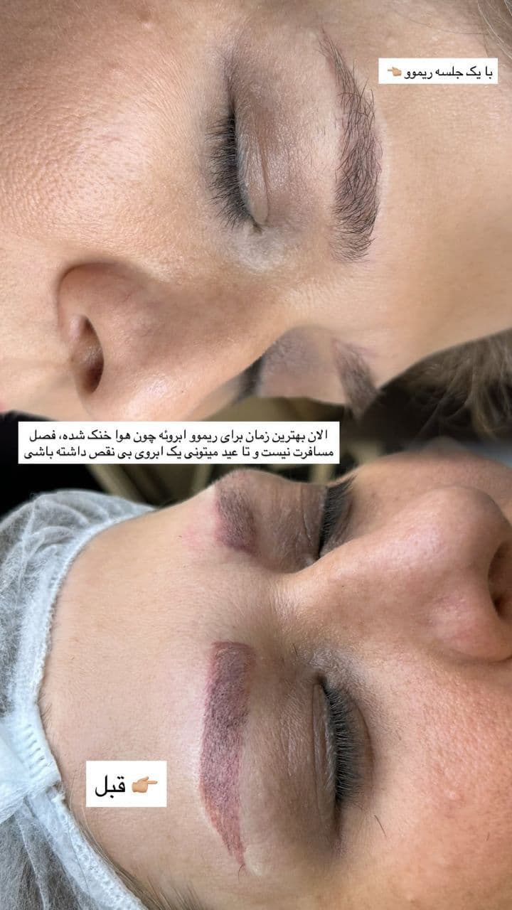 کلینیک تخصصی آرایش دائم نازنین طهماسبی در گلبهار مرکزی نجف آباد