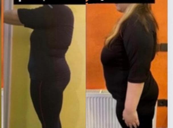 ایکس بادی لاغری ems در ونک و فرشته تهران