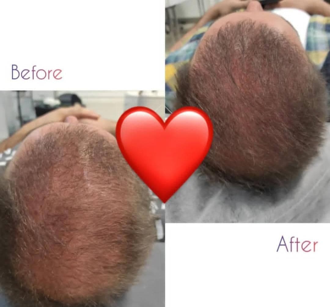 مرکز آرایش دائم و زیبایی ذوالفقاری در ملکان