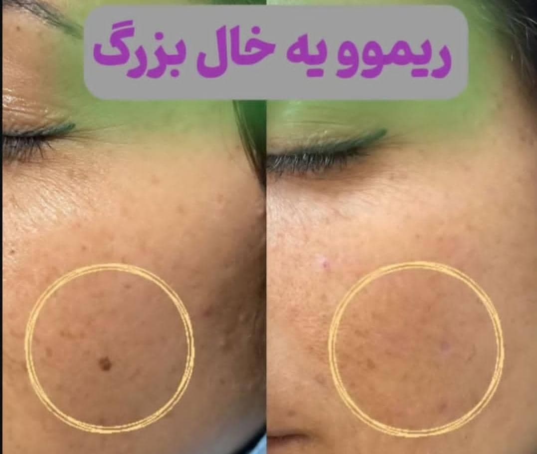 مرکز آرایش دائم و زیبایی ذوالفقاری در ملکان