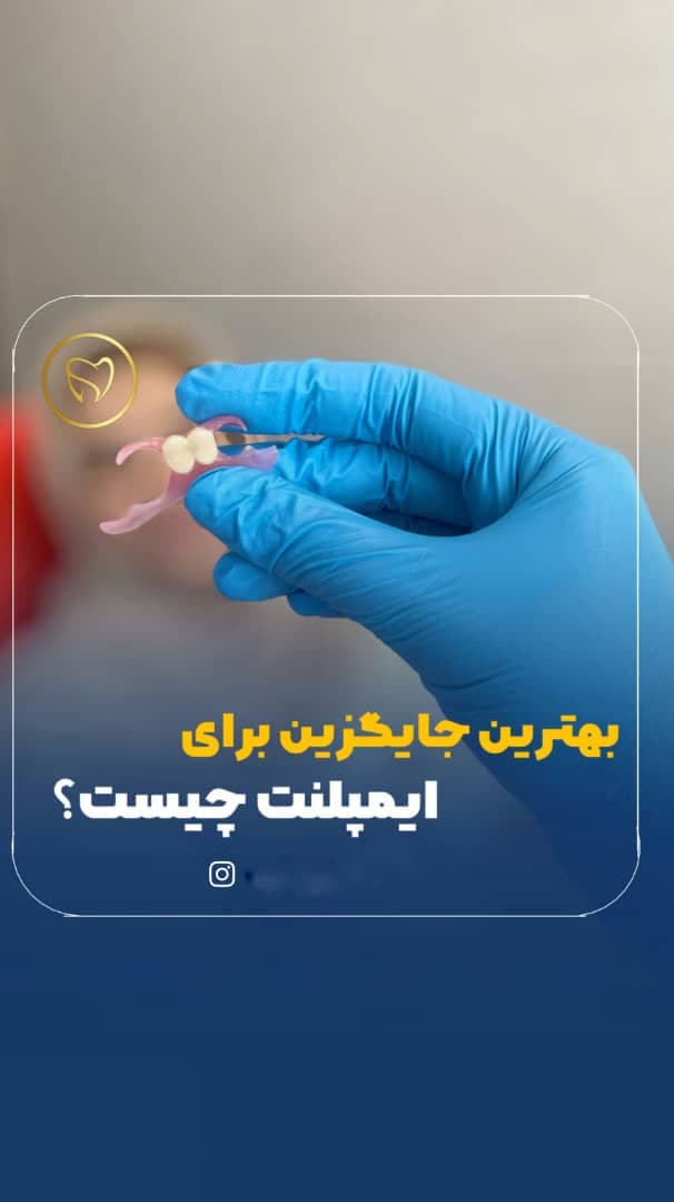مرکز تخصصی پروتز دندان مصنوعی و فلیپر پروتز دنتال در پاسداران تهران