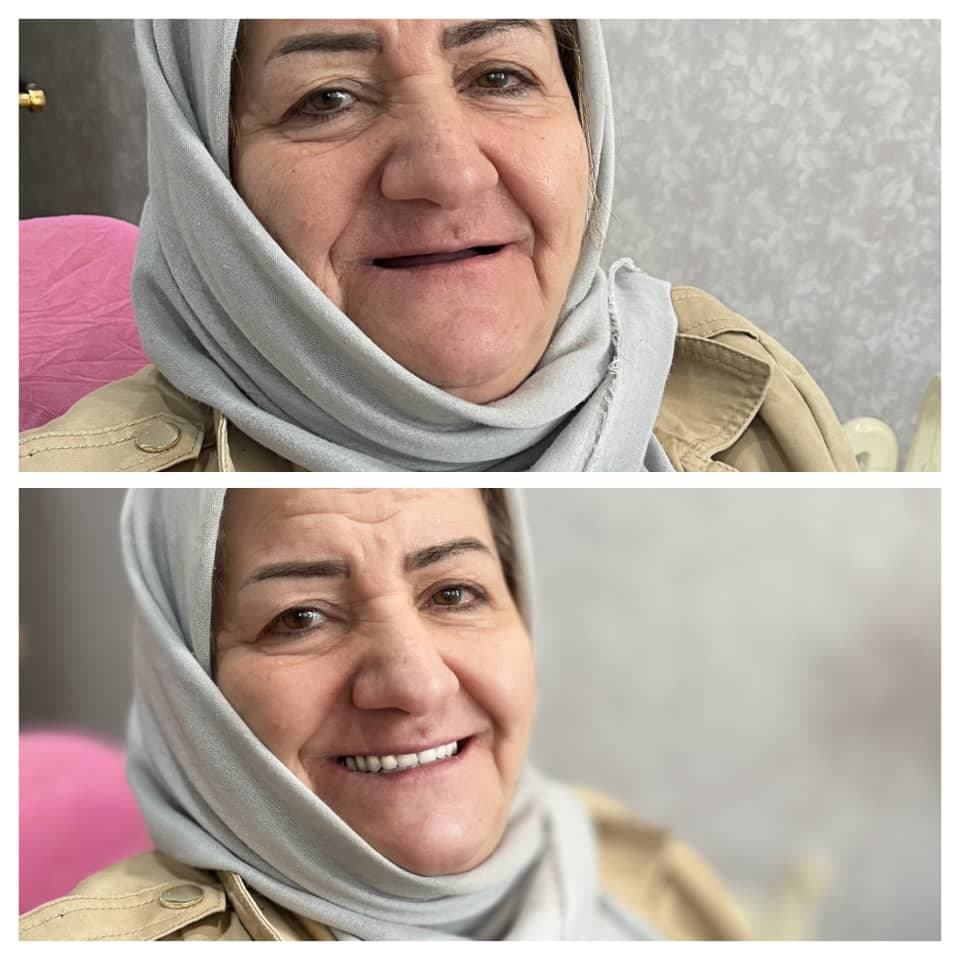 مرکز تخصصی پروتز دندان مصنوعی و فلیپر پروتز دنتال در پاسداران تهران