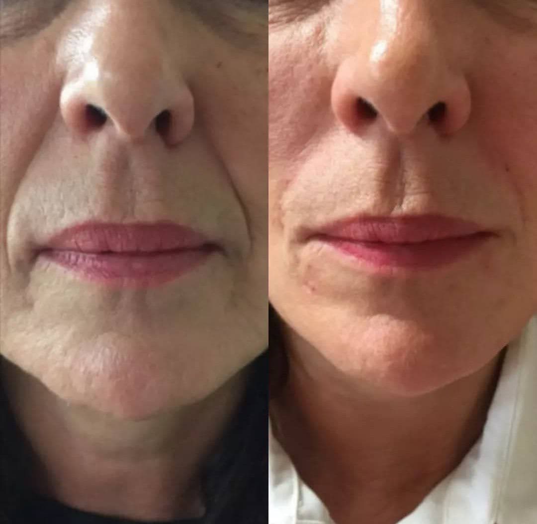 کلینیک زیبایی و لاغری لوتوس دکتر حصاری در بجنورد