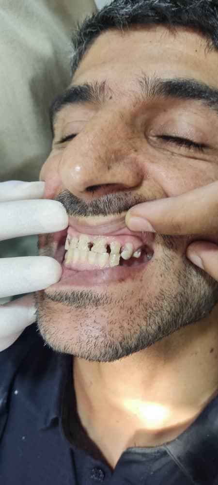 کلینیک دندان سازی دکتر روهنده در قشم