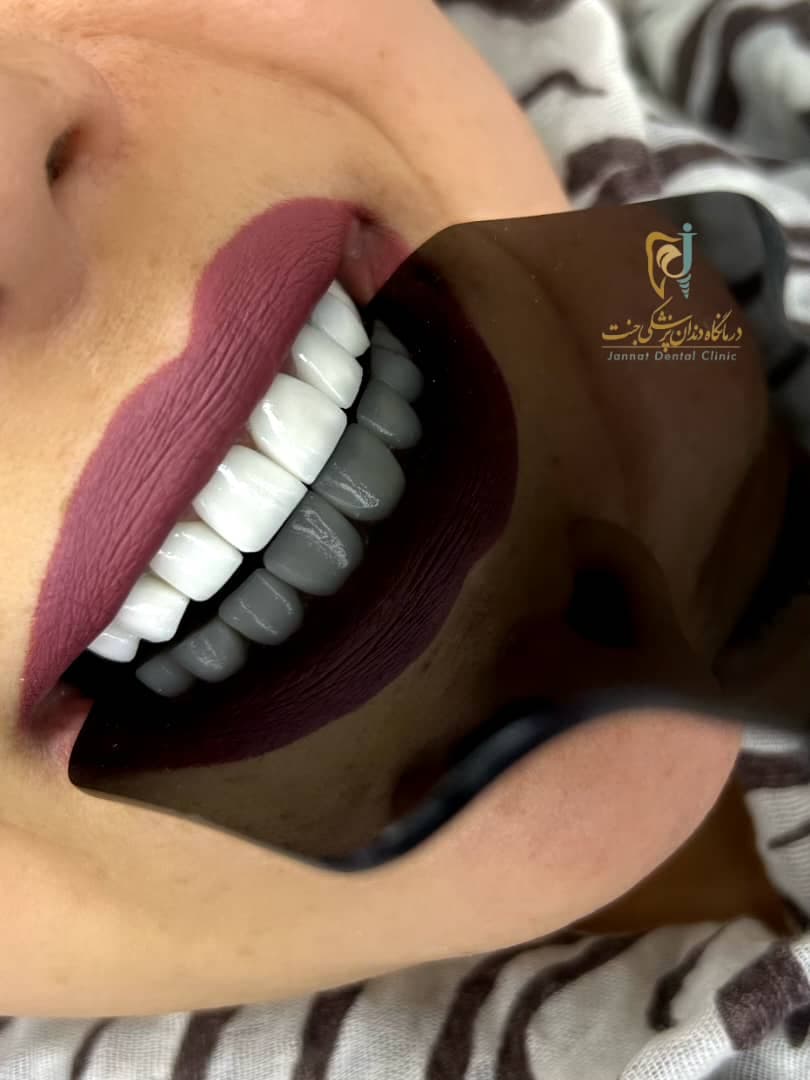 درمانگاه تخصصی دندانپزشکی جنت در اردبیل