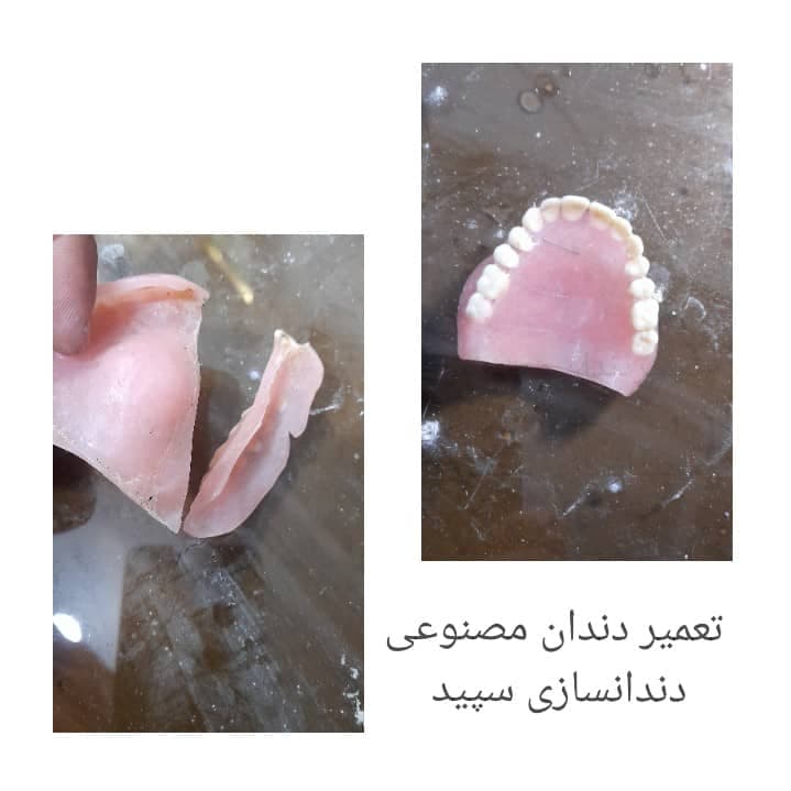 دندانسازی سپید در لاهیجان