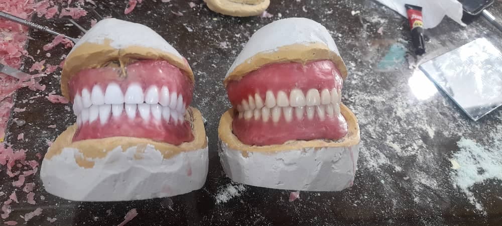 دندانسازی سپید در لاهیجان