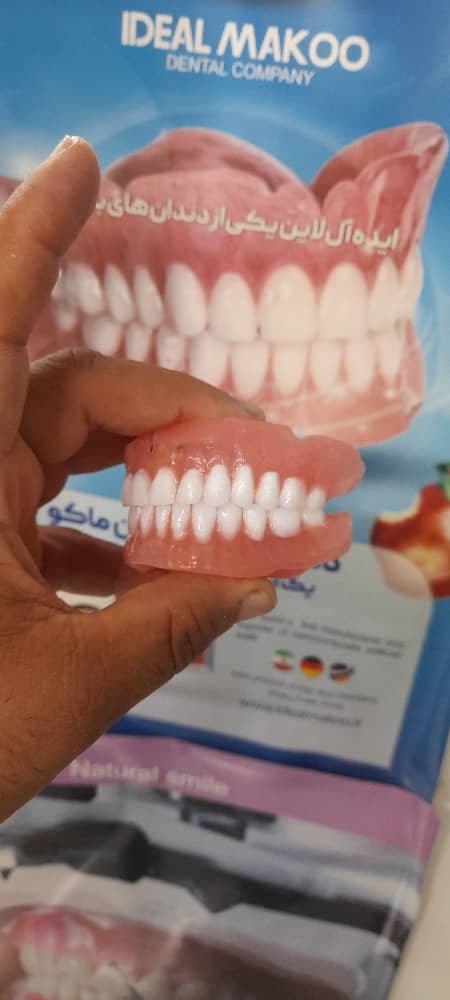 دندانسازی سپید در لاهیجان