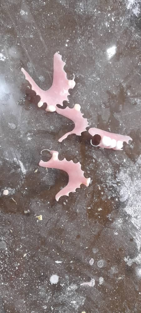 دندانسازی سپید در لاهیجان