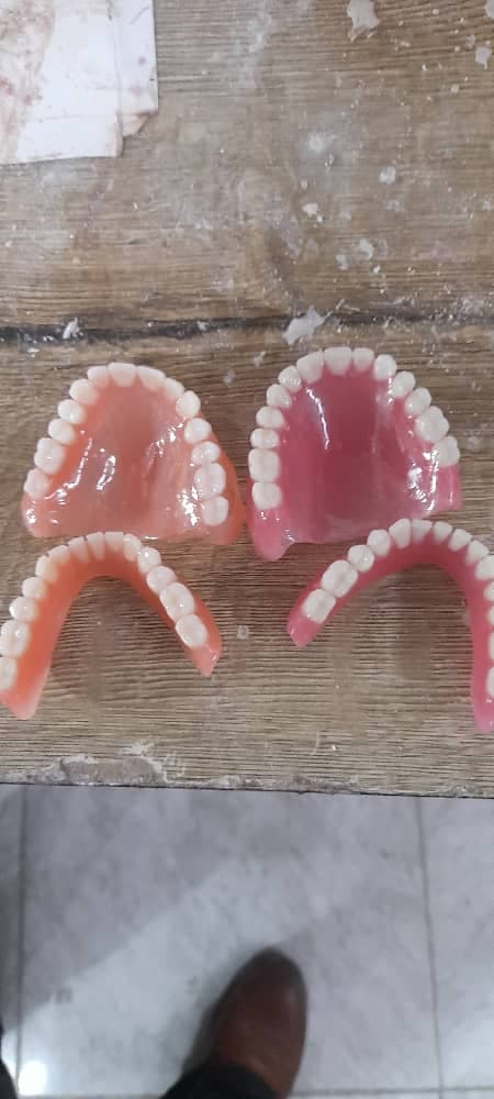 دندانسازی سپید در لاهیجان