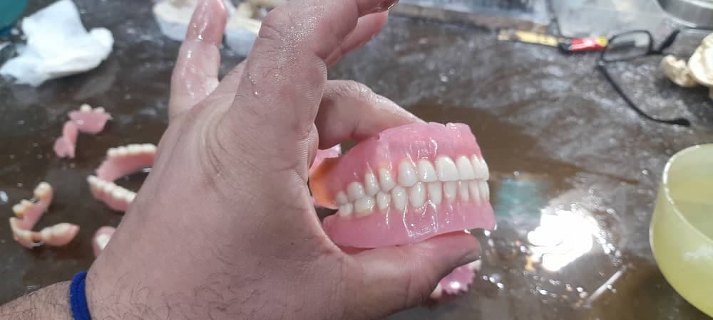 دندانسازی سپید در لاهیجان