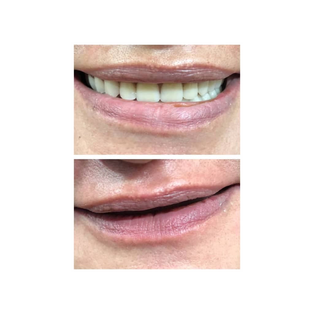 دندانسازی شکوهی یزد