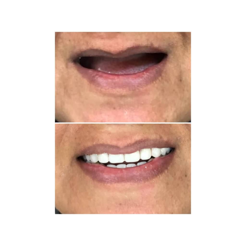 دندانسازی شکوهی یزد