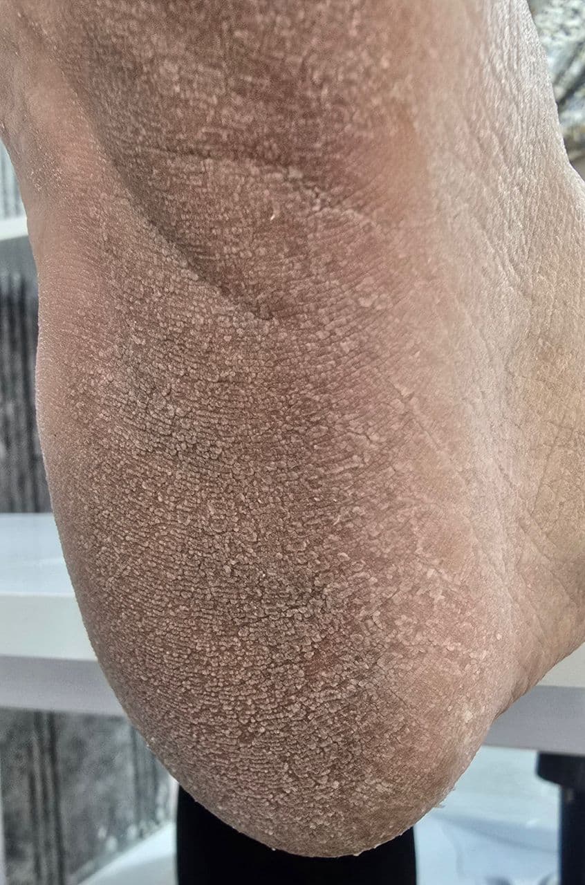 آموزش و خدمات تخصصی پدیکور روسی و درمان ترک پا فرح اسدالله پور در رفسنجان