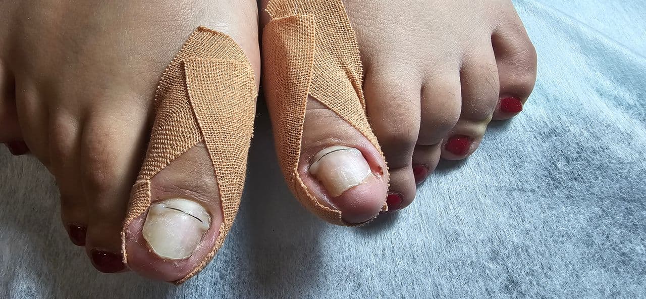 آموزش و خدمات تخصصی پدیکور روسی و درمان ترک پا فرح اسدالله پور در رفسنجان