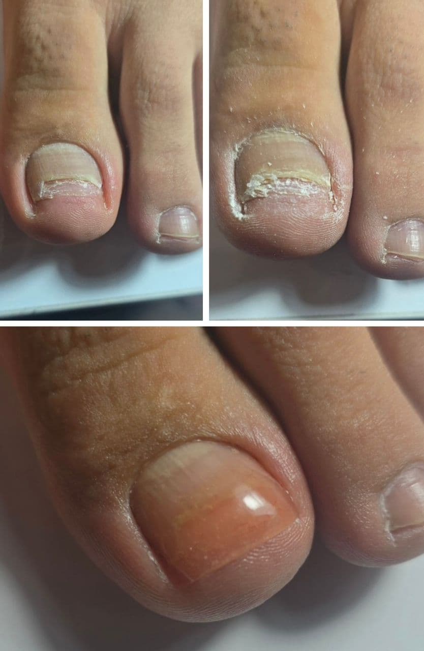 آموزش و خدمات تخصصی پدیکور روسی و درمان ترک پا فرح اسدالله پور در رفسنجان