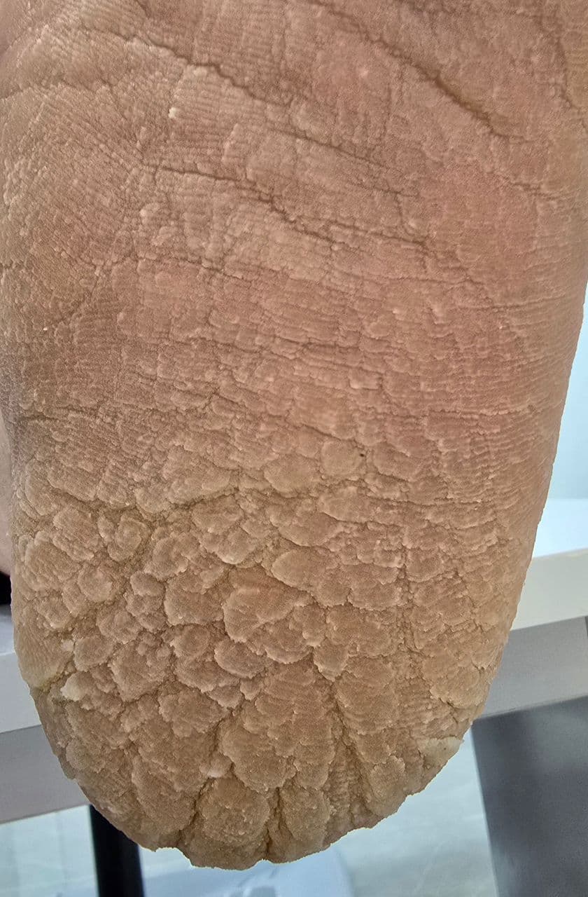 آموزش و خدمات تخصصی پدیکور روسی و درمان ترک پا فرح اسدالله پور در رفسنجان