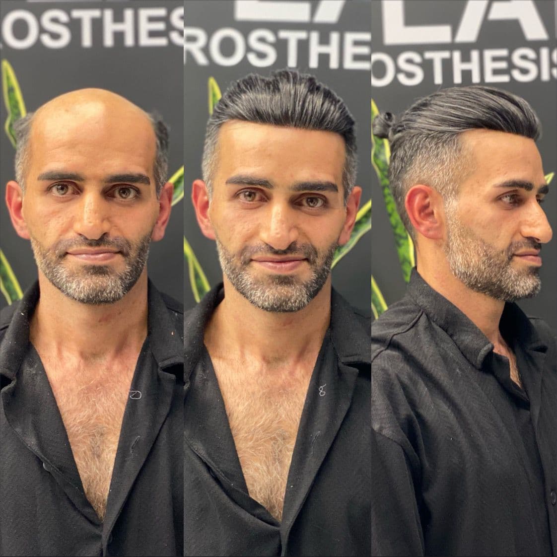 خدمات پروتز مو و میکروبلیدینگ با استایل مردانه محمد افلاک در قزوین