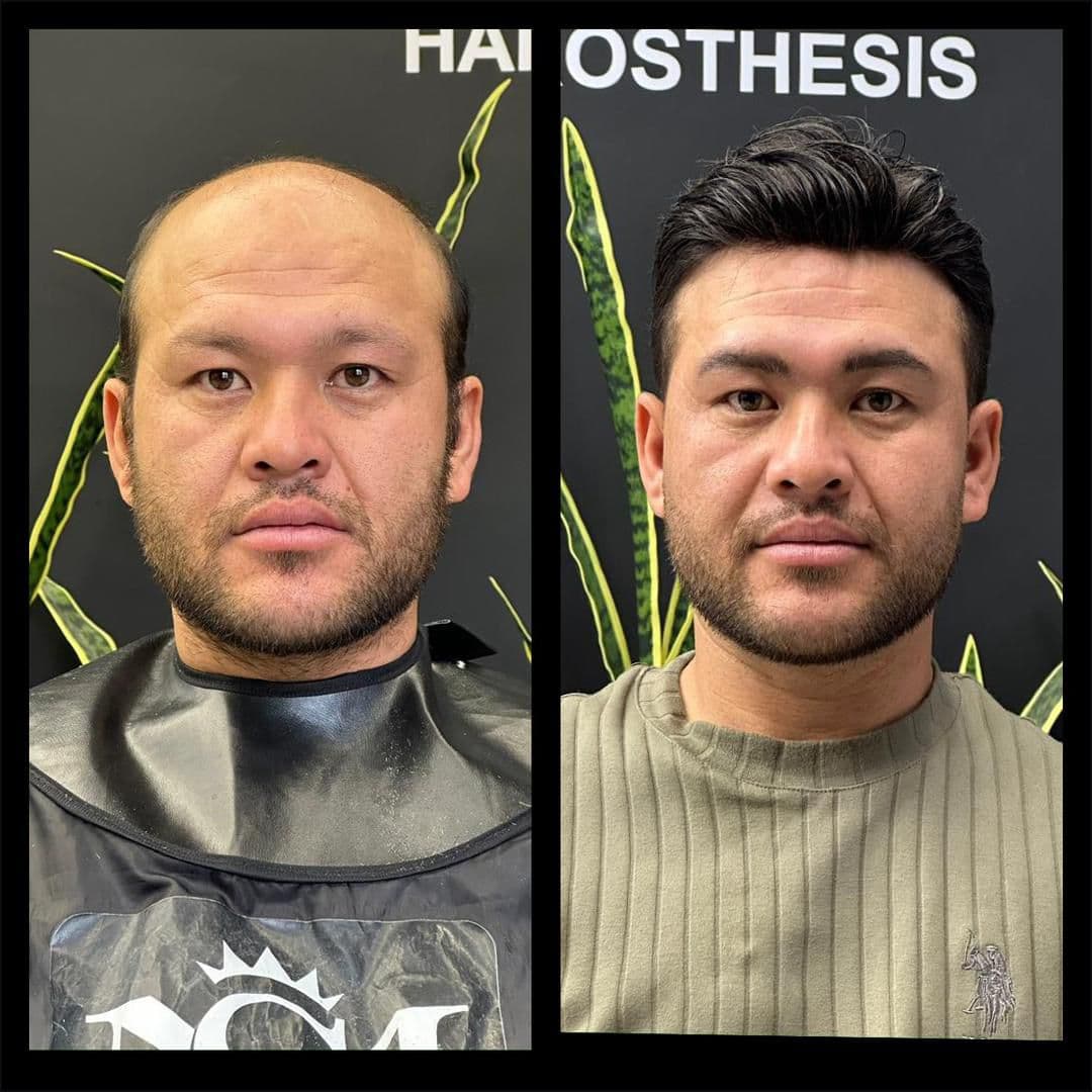 خدمات پروتز مو و میکروبلیدینگ با استایل مردانه محمد افلاک در قزوین