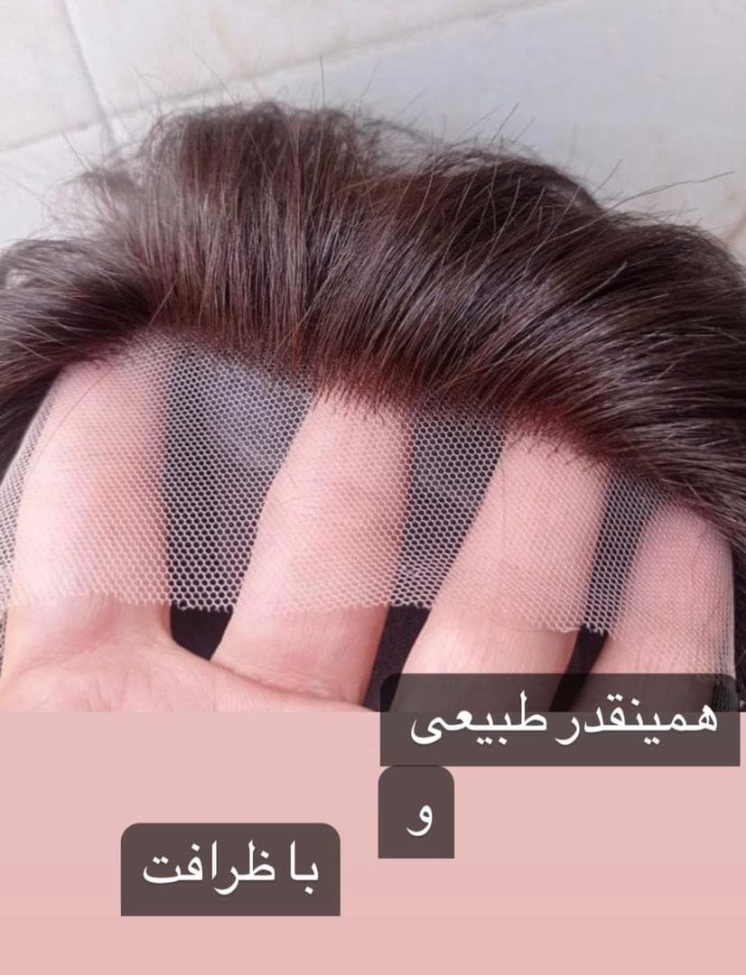 تولید عمده پروتز مو طبیعی جلوسری بالاسری تمام سری gilan wig تهران