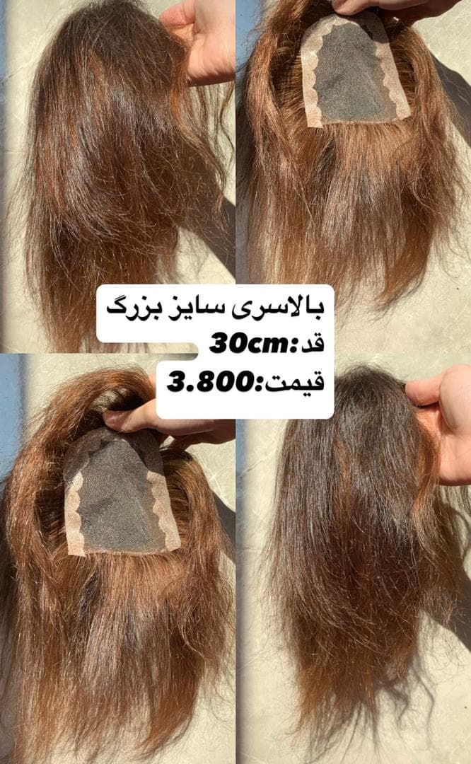 تولید عمده پروتز مو طبیعی جلوسری بالاسری تمام سری gilan wig تهران