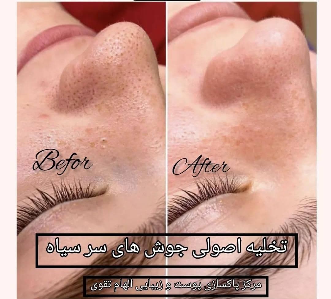 مرکز پاکسازی پوست و زیبایی الهام تقوی در امیدیه