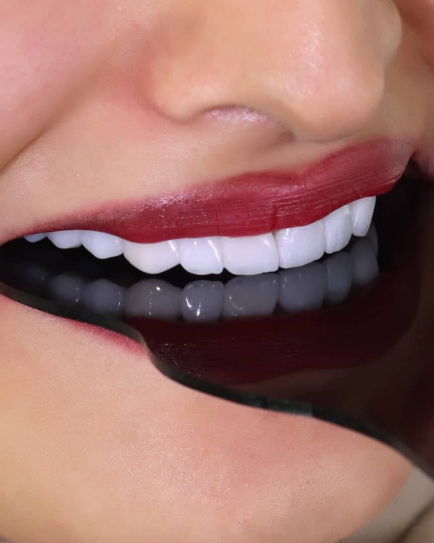 مطب دندانپزشکی دکتر محدثه نصیری در قوچان