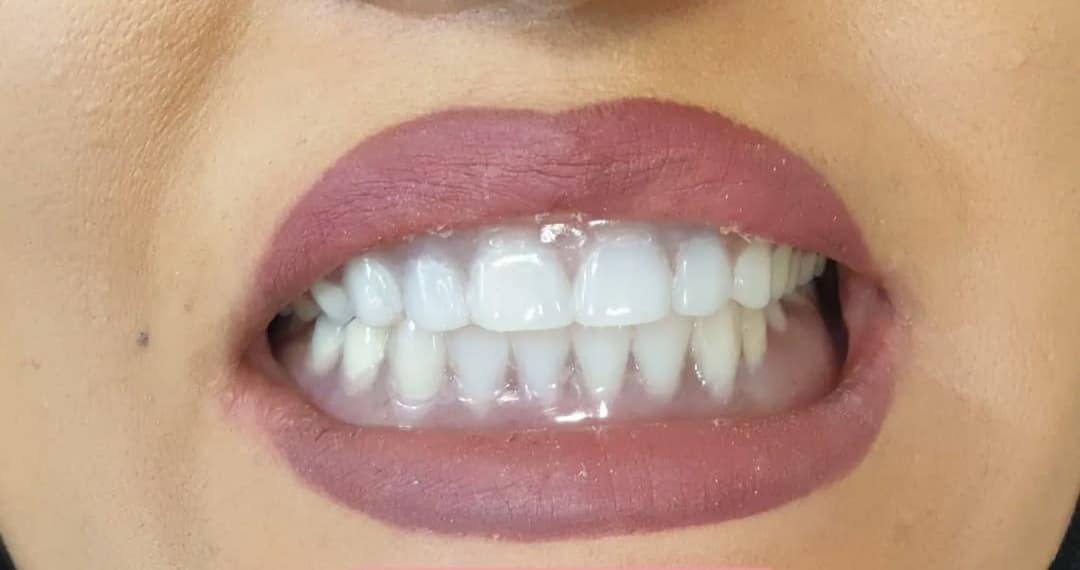 مطب دندانپزشکی تخصصی دکتر بنیکا عباسی در اصفهان