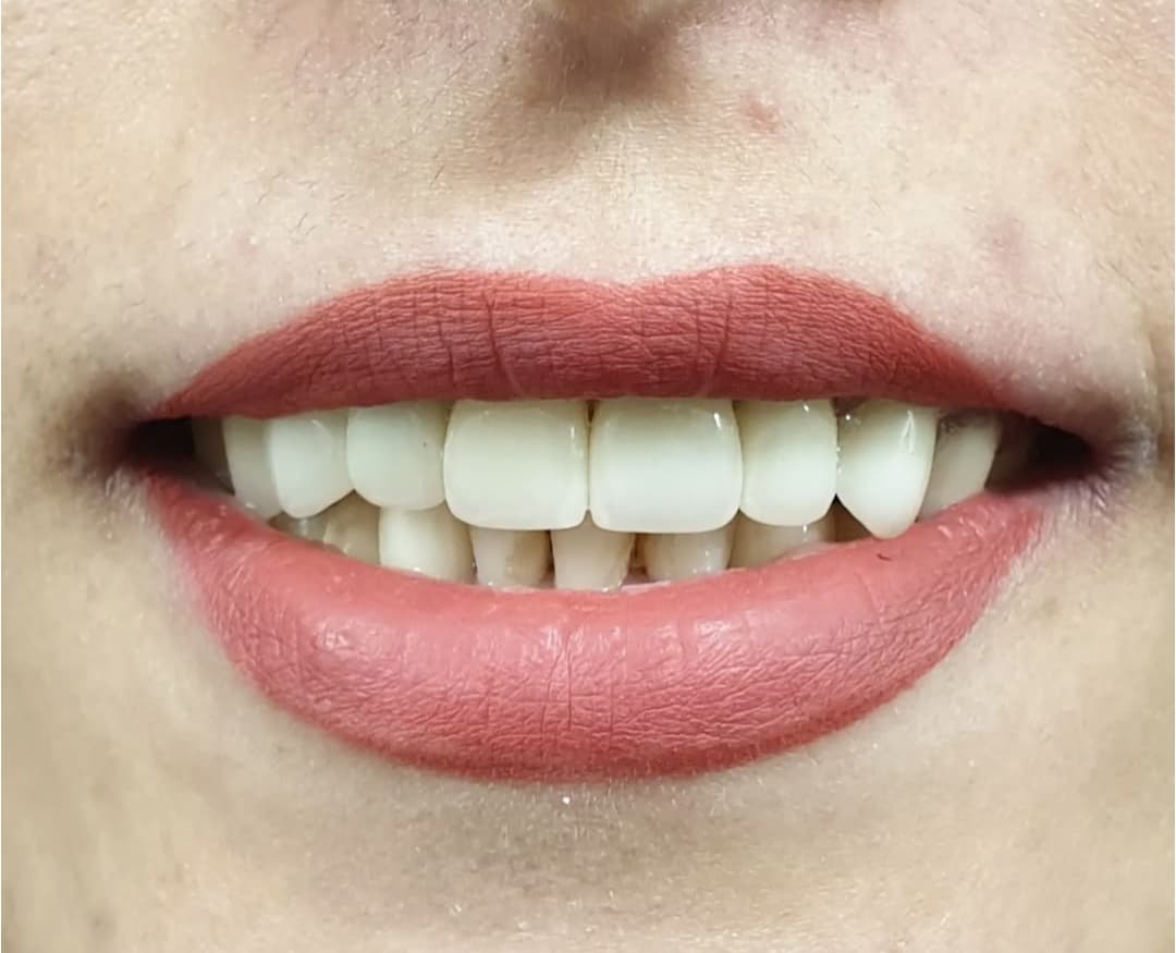 مطب دندانپزشکی تخصصی دکتر بنیکا عباسی در اصفهان