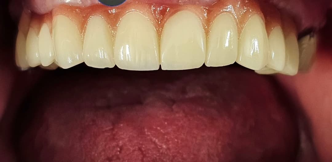 مطب دندانپزشکی تخصصی دکتر بنیکا عباسی در اصفهان